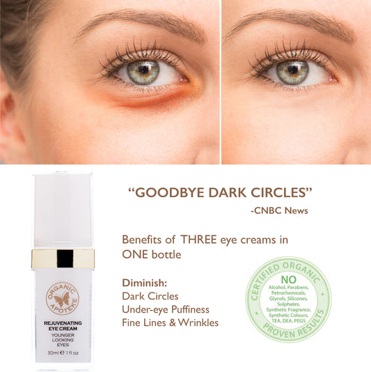 Organic Apoteke :All You Need to Know about Dark Under-Eye Circles