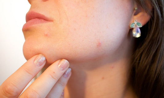 What your skin says about your health