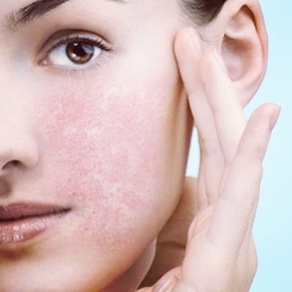 How to Care for Sensitive Skin